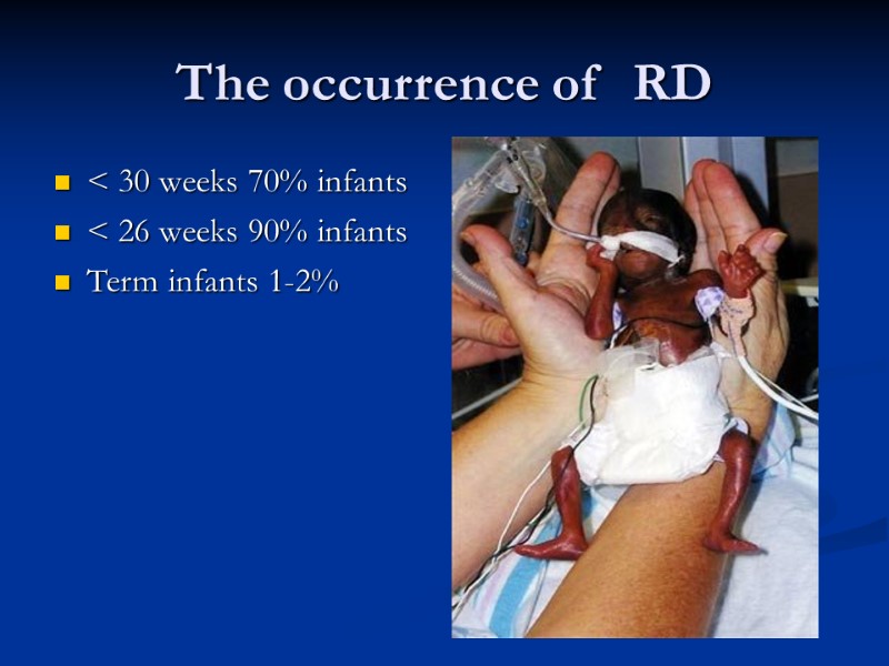 The occurrence of  RD < 30 weeks 70% infants < 26 weeks 90%